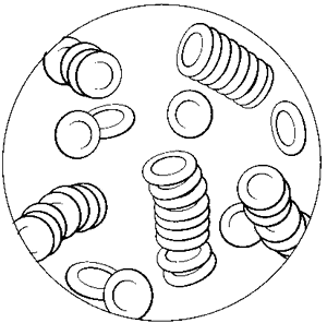 RouleauxBloodCells.gif (12139 bytes)